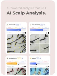 AI scalp analysis
